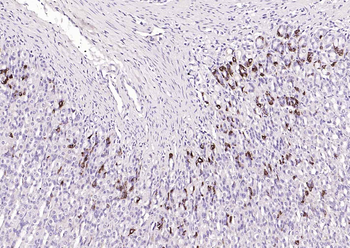 CHGA Rabbit Polyclonal Antibody