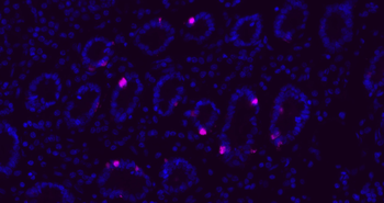 CHGA Rabbit Polyclonal Antibody
