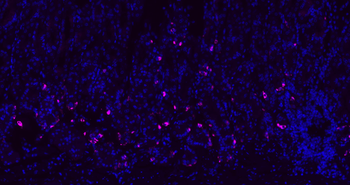 CHGA Rabbit Polyclonal Antibody