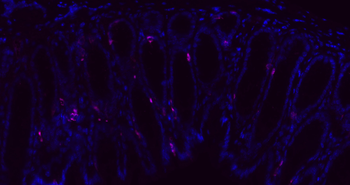 CHGA Rabbit Polyclonal Antibody
