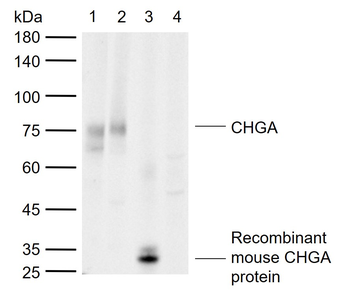CHGA Rabbit Polyclonal Antibody