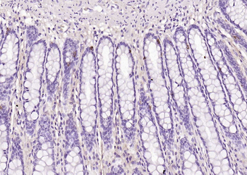 CHGA Rabbit Polyclonal Antibody
