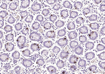CHGA Rabbit Polyclonal Antibody