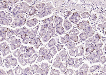 CHGA Rabbit Polyclonal Antibody
