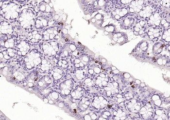 CHGA Rabbit Polyclonal Antibody