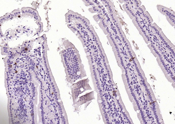 CHGA Rabbit Polyclonal Antibody