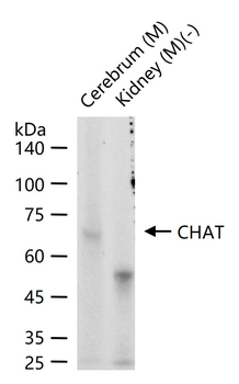 CHAT Mouse Monoclonal Antibody