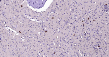 CHAT Mouse Monoclonal Antibody