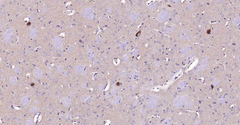 CHAT Mouse Monoclonal Antibody