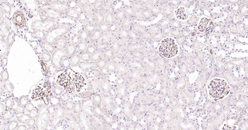 VEGFA Recombinant Rabbit Monoclonal Antibody