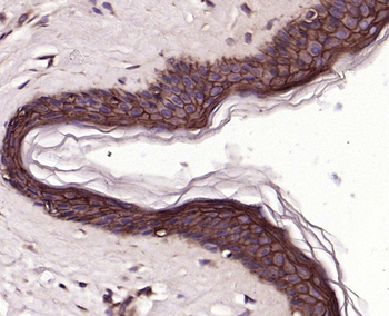 TROP2 Mouse Monoclonal Antibody