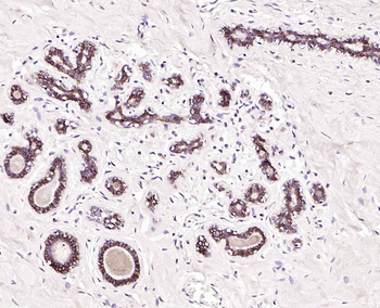 TROP2 Mouse Monoclonal Antibody