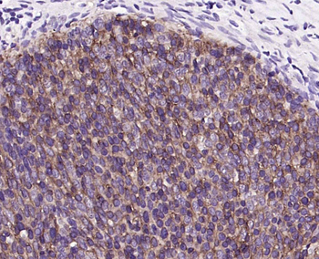 TROP2 Mouse Monoclonal Antibody