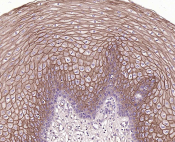 TROP2 Mouse Monoclonal Antibody