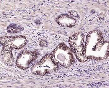 TROP2 Mouse Monoclonal Antibody