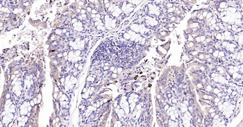 Beclin 1 Recombinant Rabbit Monoclonal Antibody