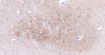 Beclin 1 Recombinant Rabbit Monoclonal Antibody