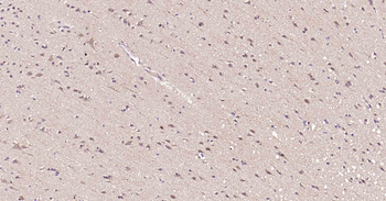 Beclin 1 Recombinant Rabbit Monoclonal Antibody