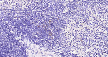 Granzyme B Recombinant Rabbit Monoclonal Antibody