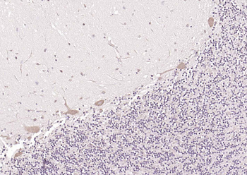 CRTC1 Rabbit Polyclonal Antibody