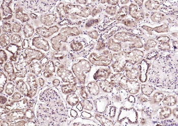 CRTC1 Rabbit Polyclonal Antibody