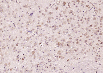 CRTC1 Rabbit Polyclonal Antibody