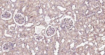 DDIT3 Recombinant Rabbit Monoclonal Antibody