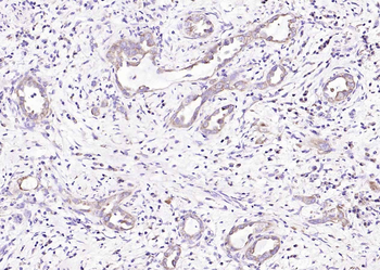 SPARC Rabbit Polyclonal Antibody