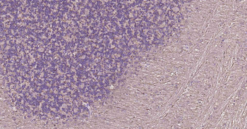 Tau Recombinant Rabbit Monoclonal Antibody