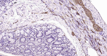 Tau Recombinant Rabbit Monoclonal Antibody