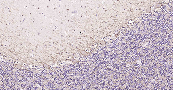 Tau Recombinant Rabbit Monoclonal Antibody