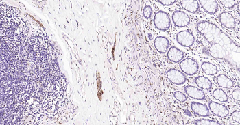 Tau Recombinant Rabbit Monoclonal Antibody