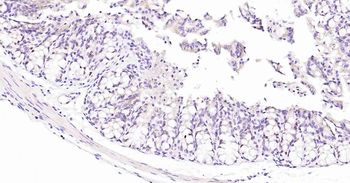 Ki67 Recombinant Rabbit Monoclonal Antibody