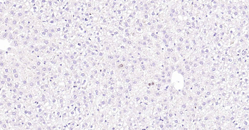 Ki67 Recombinant Rabbit Monoclonal Antibody