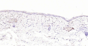 Ki67 Recombinant Rabbit Monoclonal Antibody
