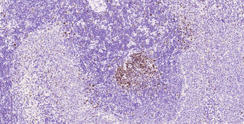 Ki67 Recombinant Rabbit Monoclonal Antibody