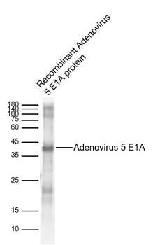 Adenovirus 5 E1A Rabbit Polyclonal Antibody