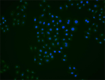 DDX27 Rabbit Polyclonal Antibody