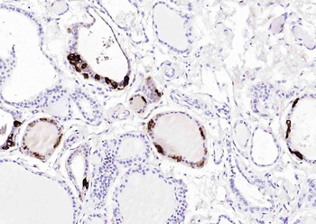 Procalcitonin (PCT) Mouse Monoclonal Antibody