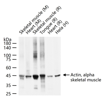 Actin, alpha skeletal muscle Mouse Monoclonal Antibody