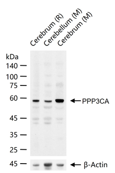 PPP3CA Rabbit Polyclonal Antibody