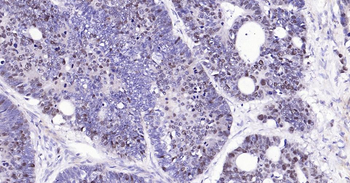 PCNA Rabbit Polyclonal Antibody