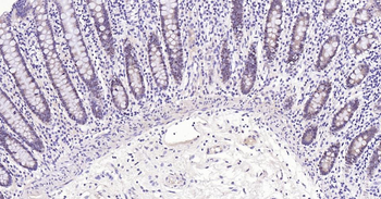 PCNA Rabbit Polyclonal Antibody