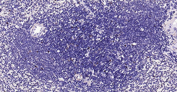 PCNA Rabbit Polyclonal Antibody