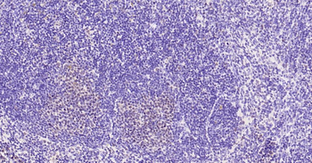 PCNA Rabbit Polyclonal Antibody