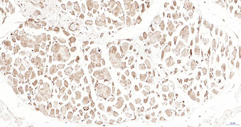 Proteasome 19S S5A Rabbit Polyclonal Antibody