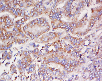 FCHSD1 Rabbit Polyclonal Antibody