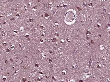 GDPD3 Rabbit Polyclonal Antibody