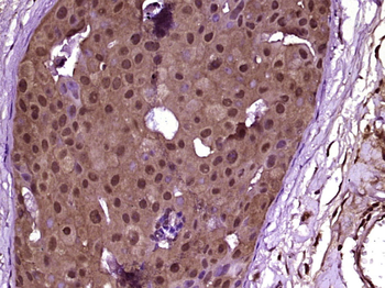 GDPD3 Rabbit Polyclonal Antibody