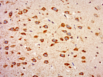 WIPF2 Rabbit Polyclonal Antibody